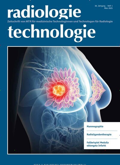 Titelbild der Ausgabe 1/2025 von radiologie technologie. Diese Zeitschrift und viele weitere Pflegezeitschriften und medizinische Fachzeitschriften als Abo oder epaper bei United Kiosk online kaufen.